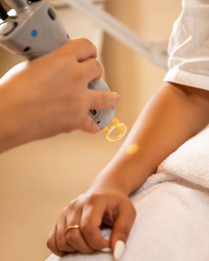 gallery-3 Close-up of a laser hair removal session at a spa, emphasizing professional skincare and relaxation.