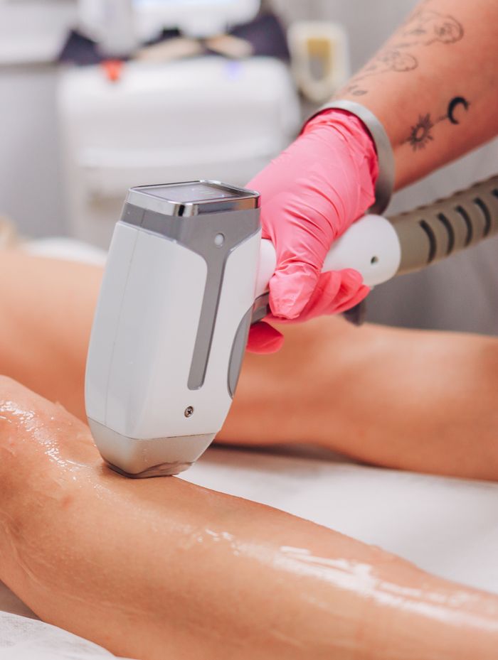 gallery-4 Close-up of laser hair removal on a client's leg in a professional clinic setting.